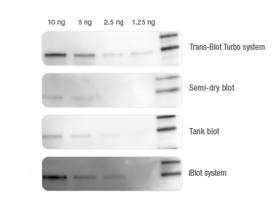 BIO-RAD Trans-Blot®Turbo美國(guó)伯樂全能型蛋白轉(zhuǎn)印系統(tǒng)1704150