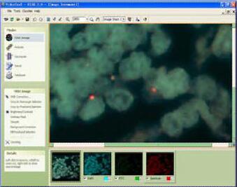 美國NVT熒光原位雜交FISH分析系統(tǒng)