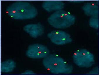 美國NVT熒光原位雜交FISH成像分析系統(tǒng)
